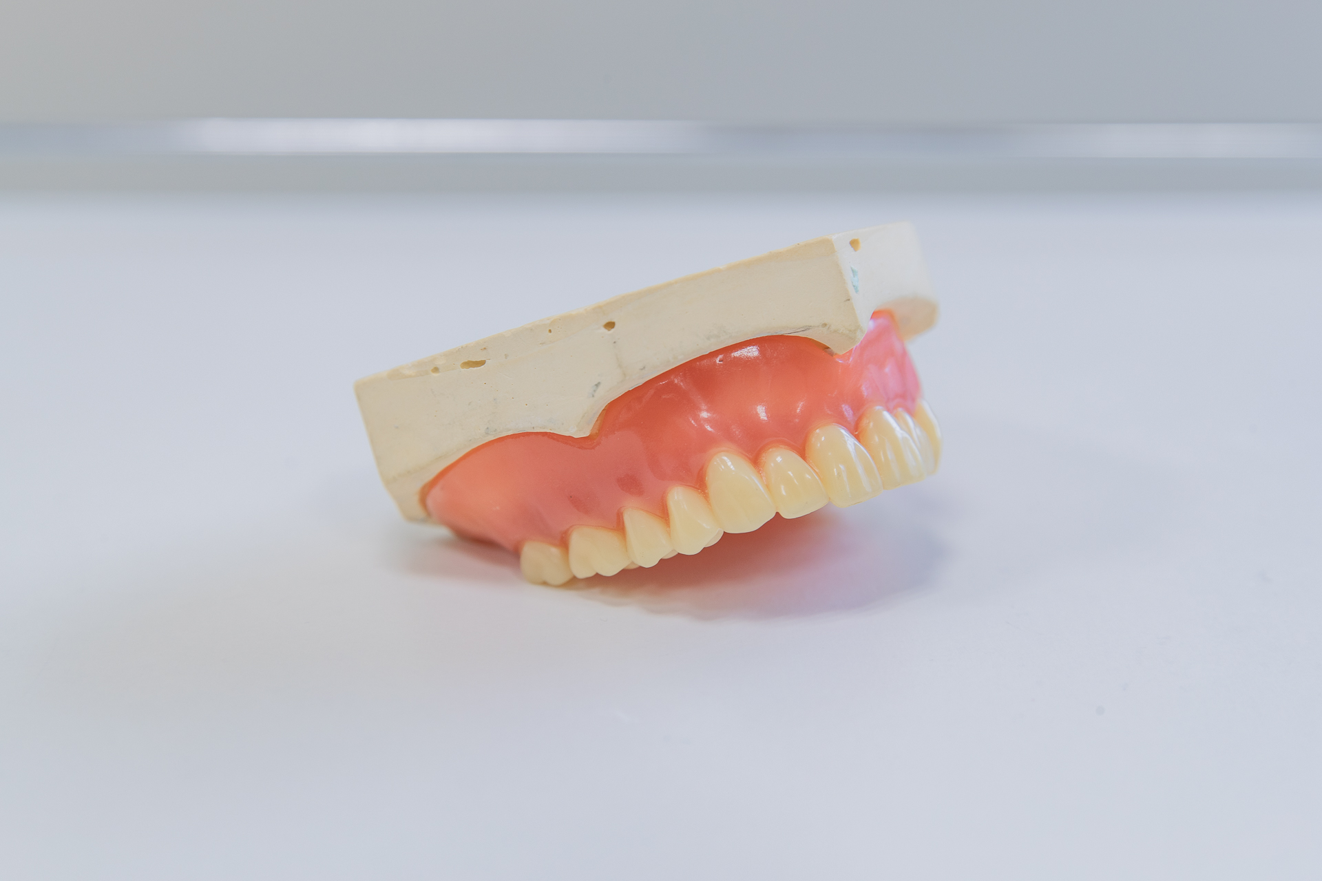 部分入れ歯とは？